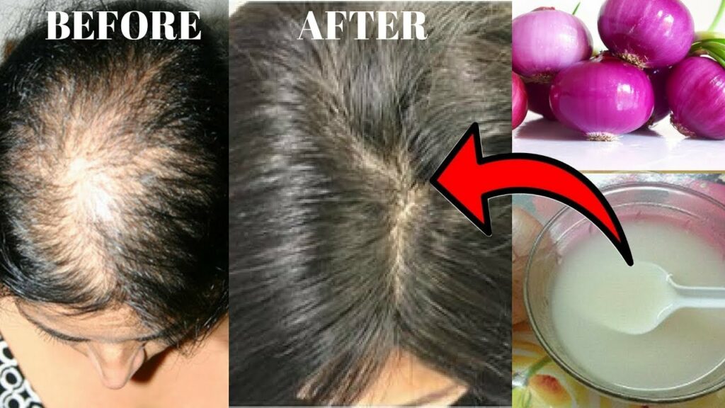 Can I use onion juice on hair daily