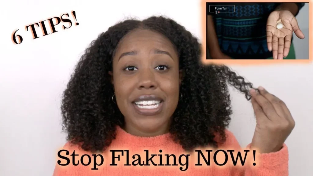 How To Get Rid Of Gel Flakes In Hair Without Washing