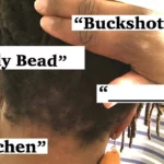 Buckshots Hair: What is it? What does it mean?